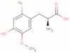 3-O-methyl-6-fluoro-dopa