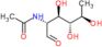 2-(acetylamino)-2,6-dideoxy-D-galactose