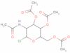 2-Acetamido-3,4,6-tri-O-acetyl-2-deoxy-α-D-glucopyranosyl chloride