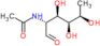 2-(acetylamino)-2,6-dideoxy-D-glucose