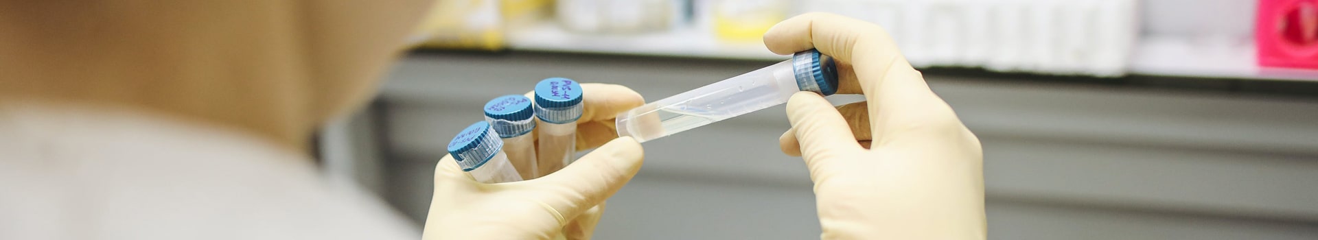 Precisión y sensibilidad: explorando los diferentes Kits ELISA