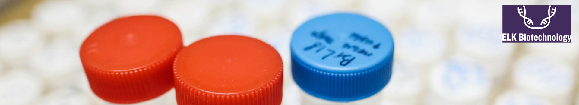 Troubleshooting of ELISA Experiment: Analysis of Common Problems and Causes