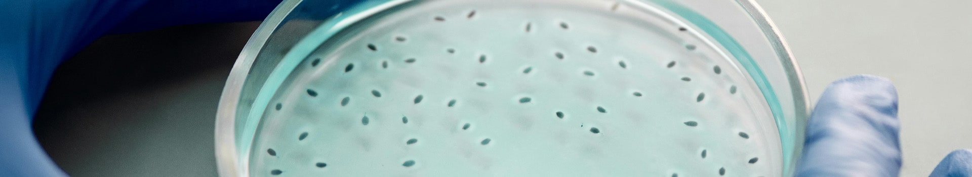 Productos esenciales para laboratorios de control de calidad microbiológica
