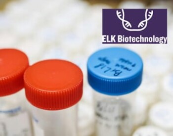 Troubleshooting of ELISA Experiment: Analysis of Common Problems and Causes