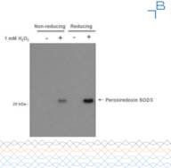 Anti-Peroxiredoxin SO2/3 antibody - 0.24mg/ml