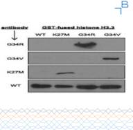 Anti-Histone H3.3 (G34R) antibody - 0.4mg/mL