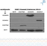 Anti-Histone H3.3 (G34V) antibody - 0.5mg/mL