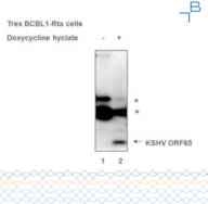 Anti-KSHV ORF65 antibody - 0.5mg/mL