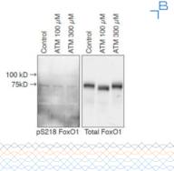 Anti-phospho-FoxO1 (pS218) antibody - 0.5mg/mL