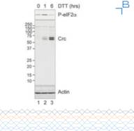 Anti-crc antibody - serum