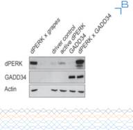 Anti-PERK antibody - serum