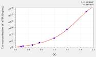 Human sTfR1(SolubleTransferrin Receptor 1) ELISA Kit