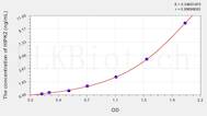 Human HIPK2(Homeodomain Interacting Protein Kinase 2) ELISA Kit