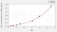 Mouse ATP4b(ATPase, H+/K+ Exchanging β Polypeptide) ELISA Kit