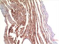 VE-Cadherin (8E5) Mouse mAb